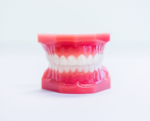 invisalign santa ana